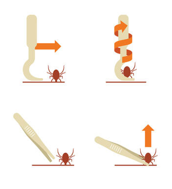 Sch&eacute;ma retrait tique