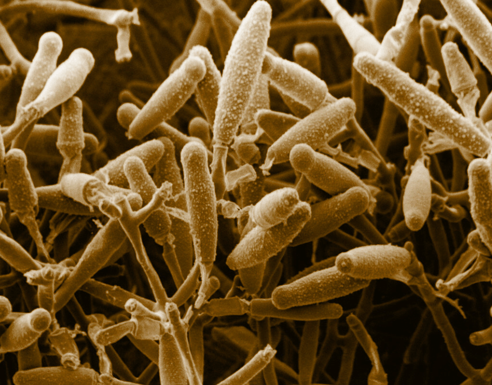 microsporum gypseum