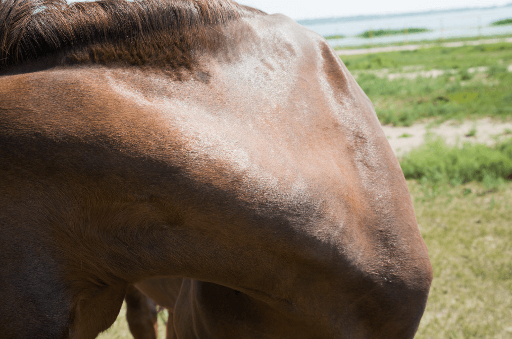 cou et &eacute;paules