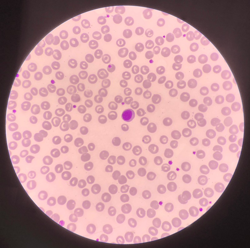 Activation du syst&egrave;me immunitaire