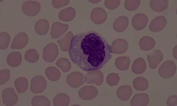 R&eacute;ponse immunitaire 