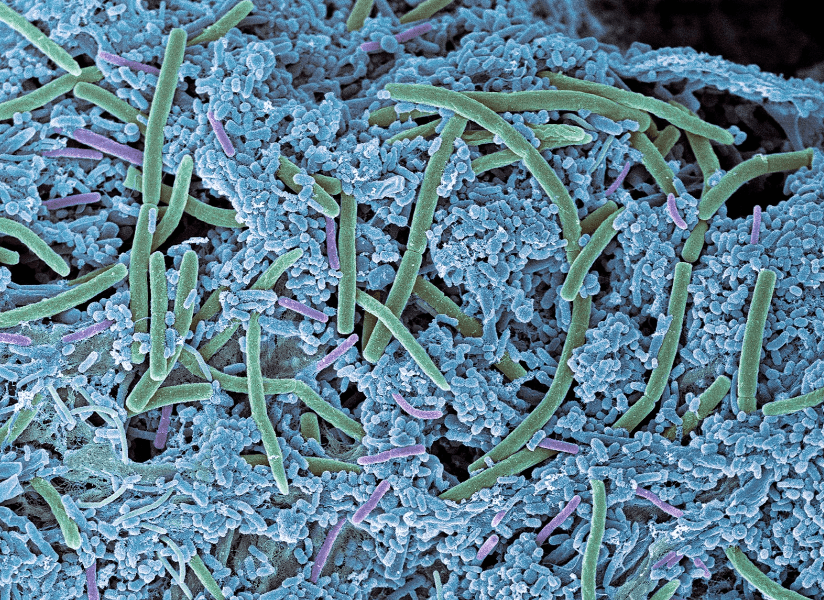 condition ana&eacute;robie bacterie cheval fourchette